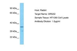OR52I2 Rabbit anti-Human, Polyclonal, Novus Biologicals 0.1 mL | Buy Online | Novus Biologicals | Fisher Scientific